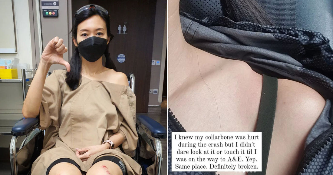 Actress Jaime Teo breaks collarbone trying to overtake cyclists at MBS